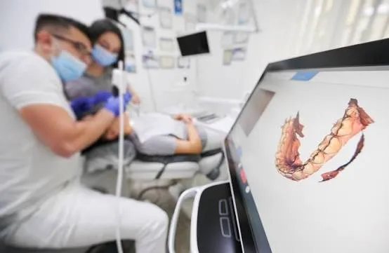3D Intraoral Dental Scanner